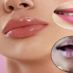 Pink Lips Home Remedies