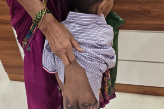 ठाणे में बच्चे को जलाने की अफवाह झूठी निकली, गर्म तवे पर गिरने से झुलसा था 6 वर्षीय मासूम
